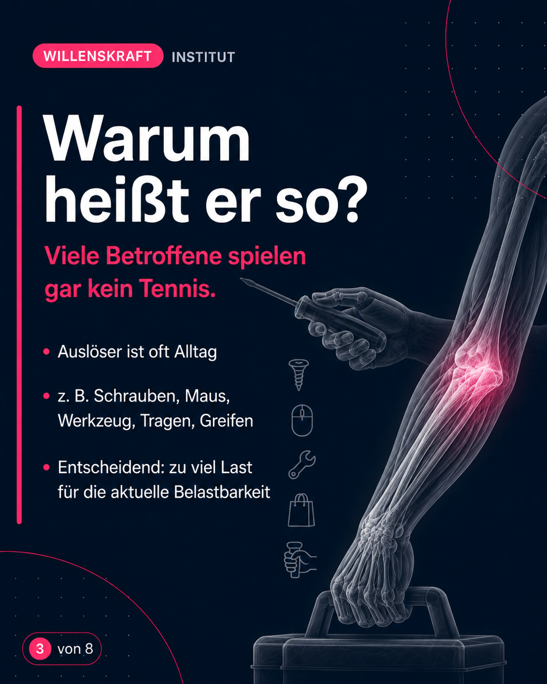 Warum heißt er so? Viele Betroffene spielen gar kein Tennis, Auslöser ist oft der Alltag. Zum Beispiel Schrauben, Nutzen einer Computermaus, Tragen und Greifen.