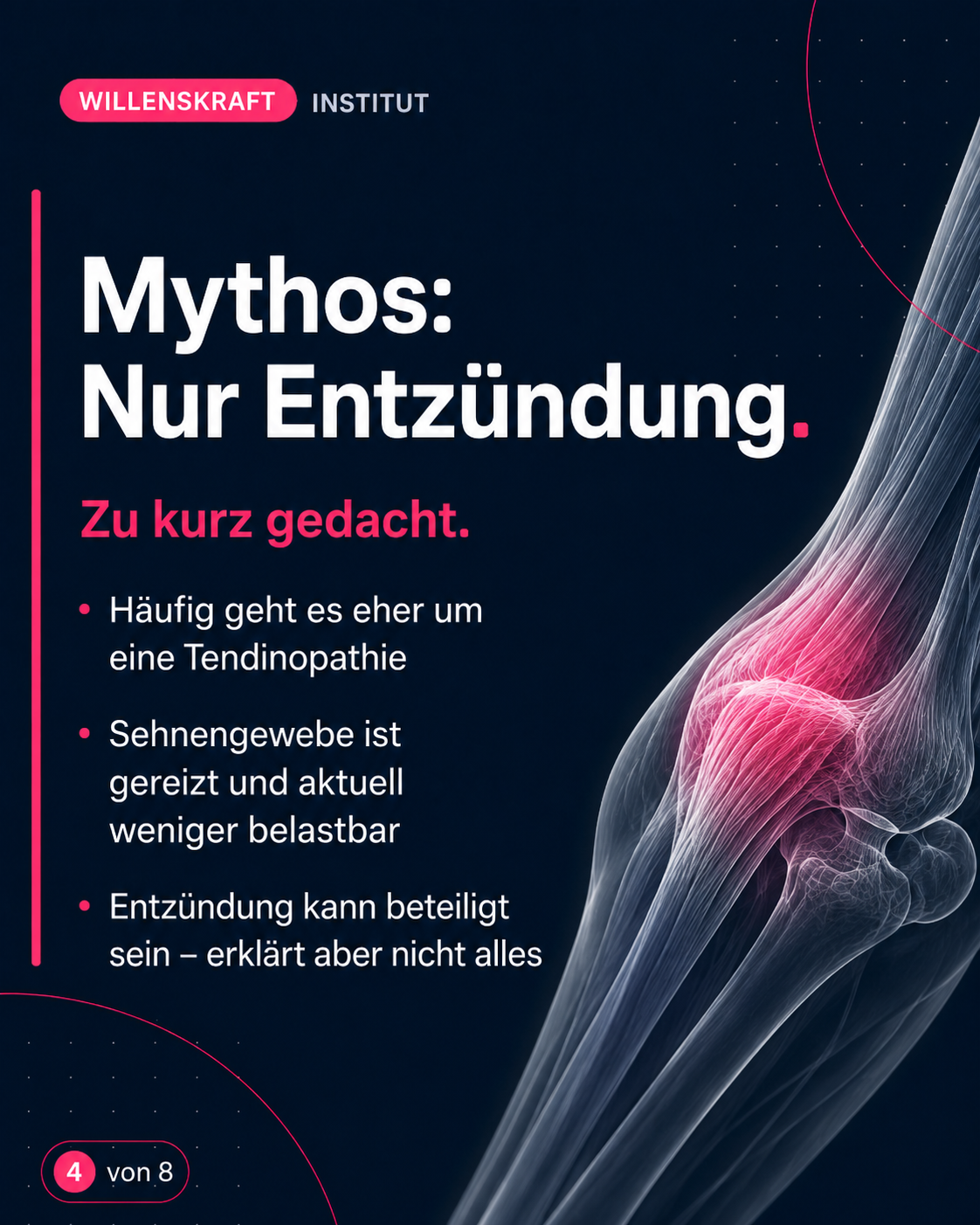 Mythos: Nur Entzündung. Häufig geht es eher um Tendinopathie, das Sehnengewebe ist gereizt und weniger Belastbar. Eine Entzündung kann beteiligt sein, erklärt aber nicht alles.