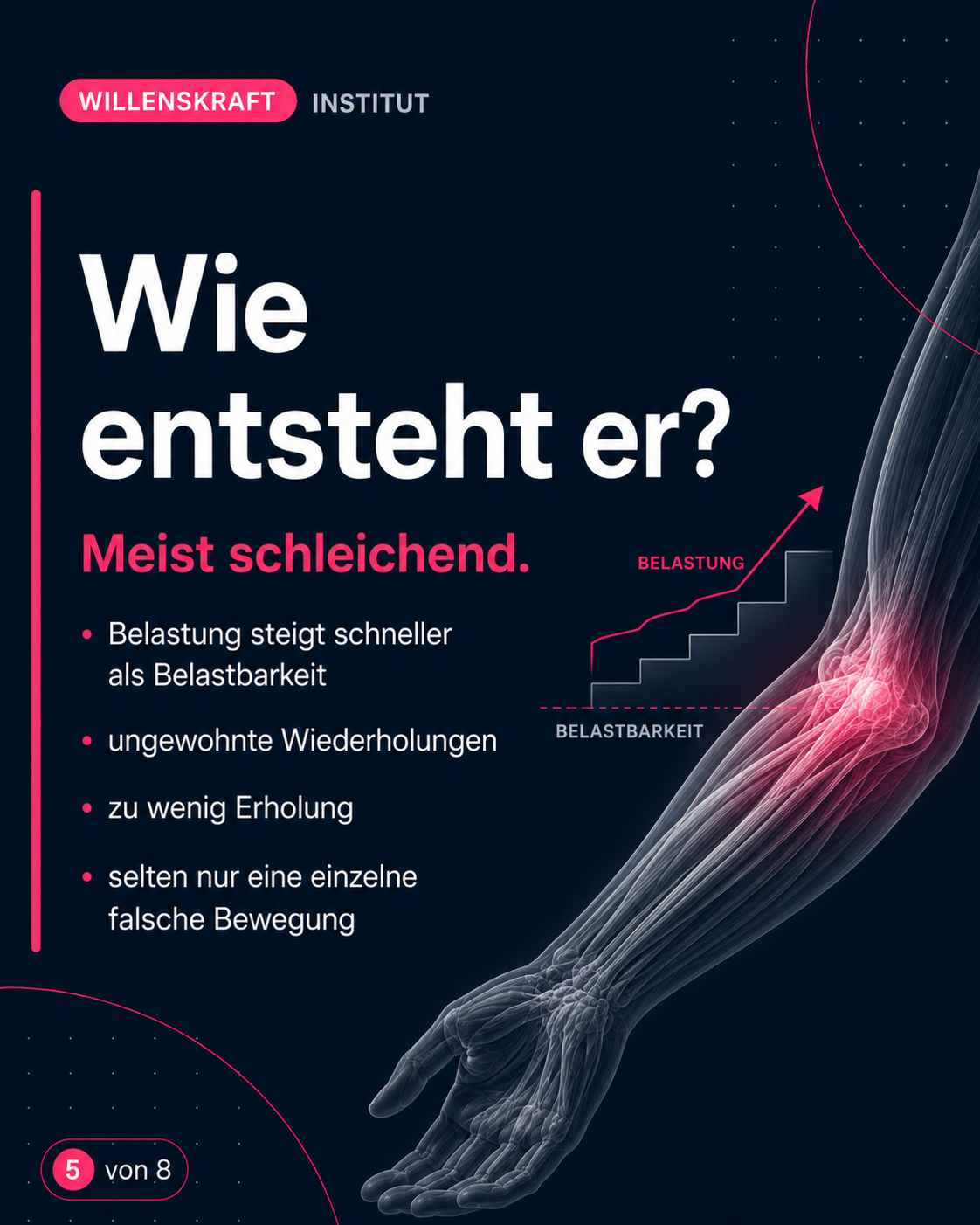 Wie ensteht er? Wenn die Belastung schneller steigt als die Belastbarkeit, durch ungewohnte Wiederholungen und zu wenig Regenerationszeit. Selten ist nur eine einzelne Bewegung der Auslöser.