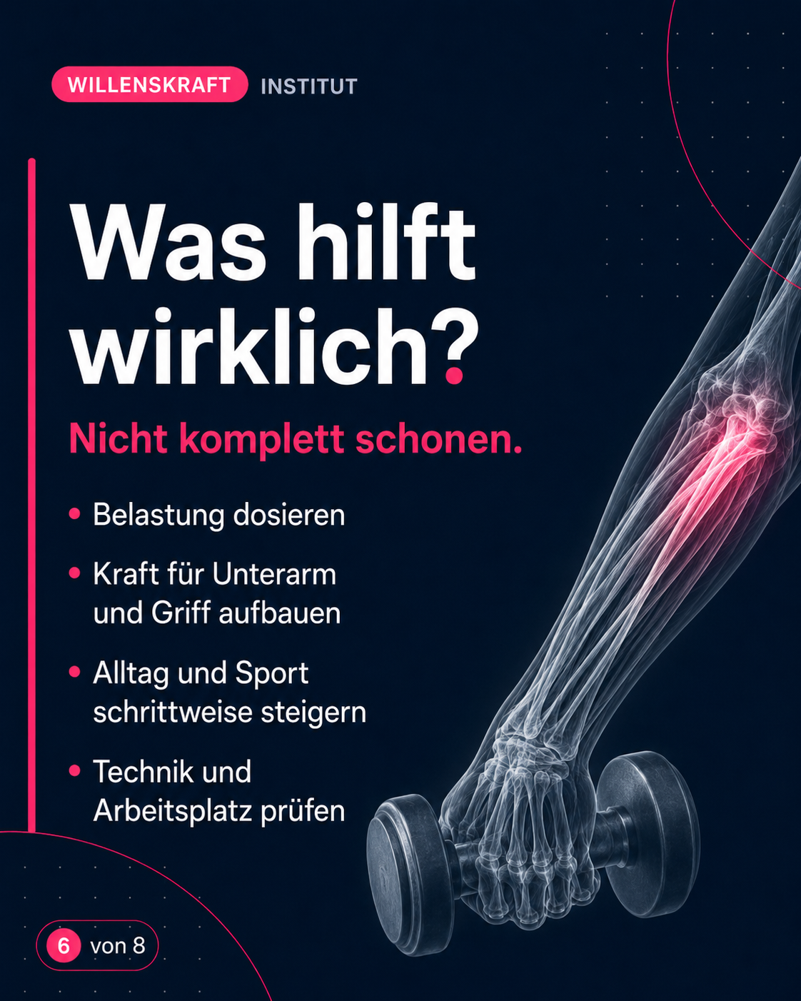 Was hilft wirklich? Der Arm sollte nicht komplett geschont werden. Wichtiger ist es die Belastbarkeit zu dosieren und Kraft für Unterarm und Griff aufzubauen. Die Alltagsbelastung und Sport schrittweise steigern.